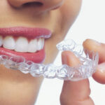 Invisalign®