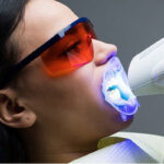 Zoom Whitening