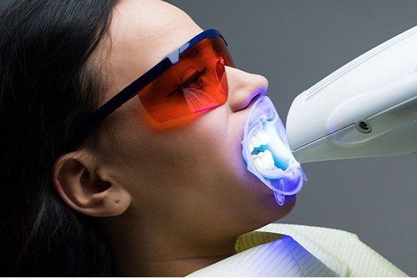 Blanqueamiento Zoom at Elite Dental Touch in Miramar, FL